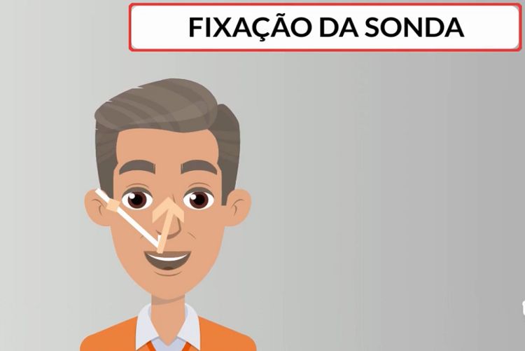 Vídeo produzido pela UFSCar e pelo HU orienta sobre cuidados a pacientes com sonda enteral em ambiente domiciliar